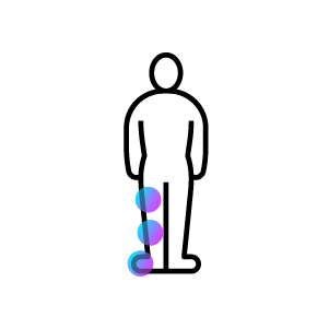 Icon showing segmental dystonia